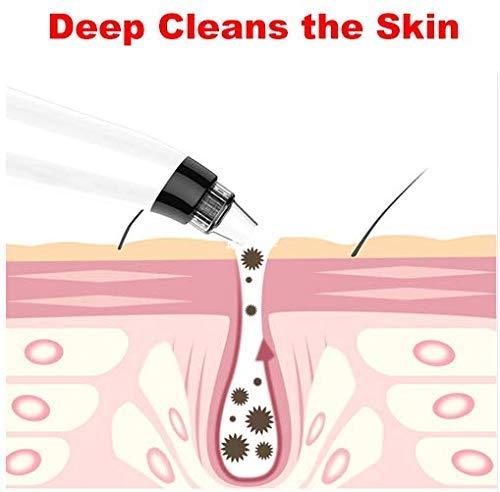 Derma suction Blackhead Remover Vacuum Acne remover| beauty Tool Black Spot Pore Cleaner askddeal.com